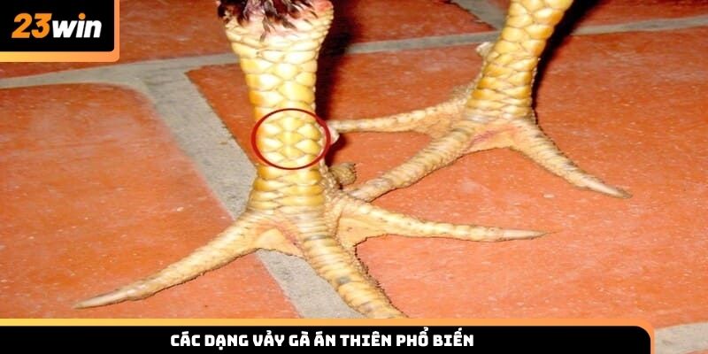 Các dạng vảy gà án thiên phổ biến